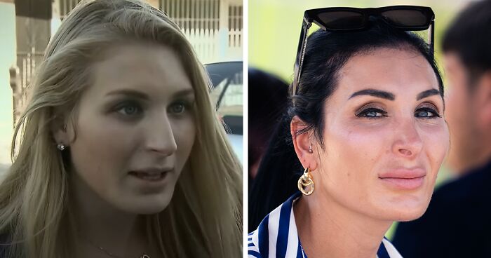 10 “Mar-a-Lago” Face Transformations That Left People Utterly Stunned