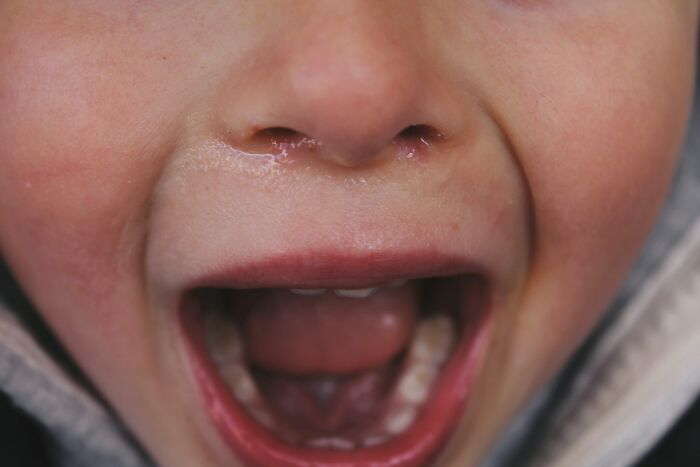 Close-up of a child's open mouth showing early teeth, illustrating true stories that sound made up but actually happened.