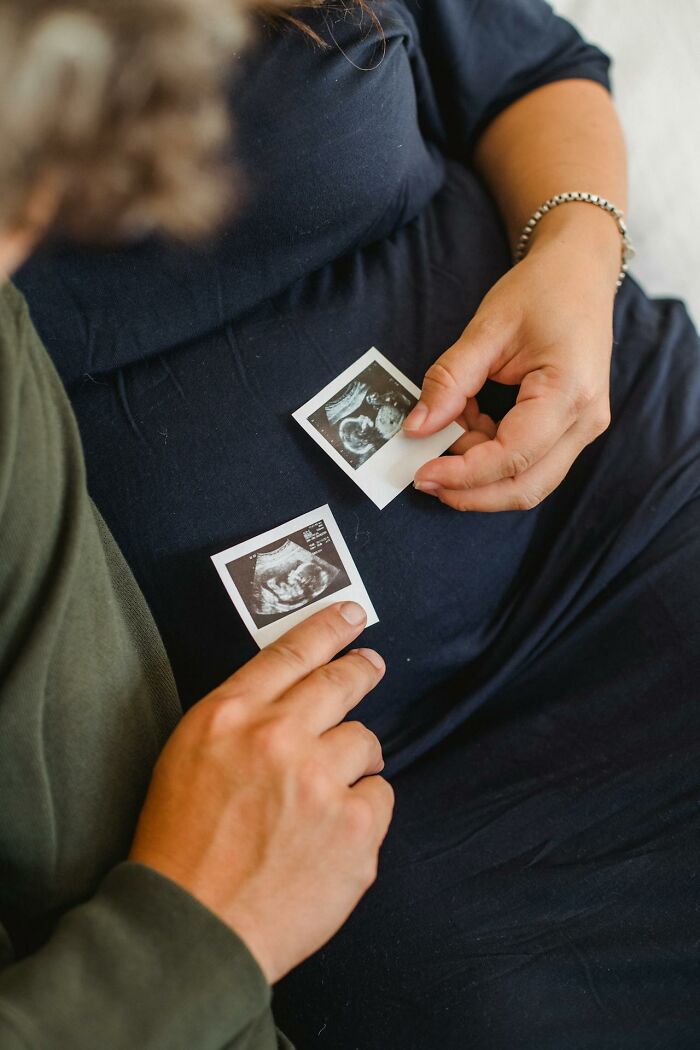 Hands holding ultrasound photos on navy blue fabric, illustrating unusual personal belongings found in lost and found.