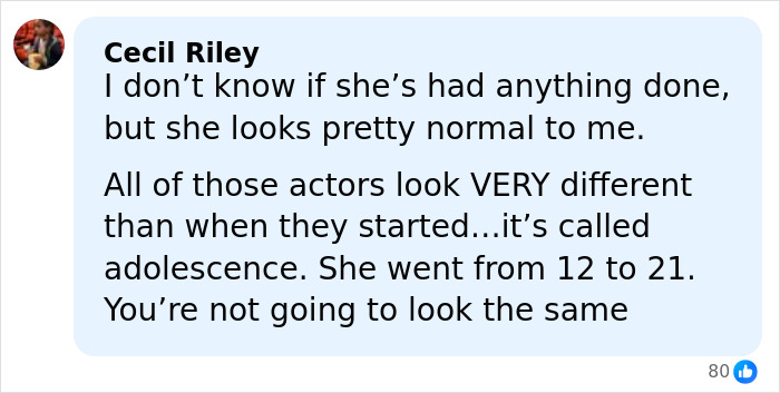 Comment discussing Millie Bobby Brown&rsquo;s appearance amid plastic surgery rumors, emphasizing natural changes over time.