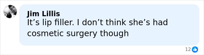 Comment about Millie Bobby Brown’s plastic surgery rumors seen in a social media post with a profile picture. Comment about Millie Bobby Brown’s plastic surgery rumors seen in a social media post with a profile picture.