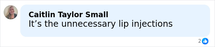Comment by Caitlin Taylor Small saying its the unnecessary lip injections discussing Millie Bobby Brown plastic surgery rumors. Comment by Caitlin Taylor Small saying its the unnecessary lip injections discussing Millie Bobby Brown plastic surgery rumors.