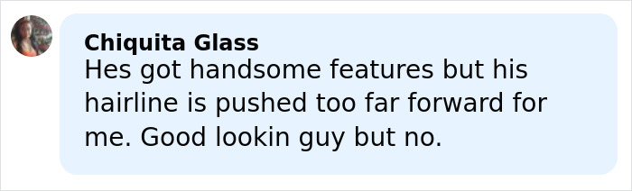Comment stating a man has handsome features but a pushed-forward hairline, questioning model material. Comment stating a man has handsome features but a pushed-forward hairline, questioning model material.