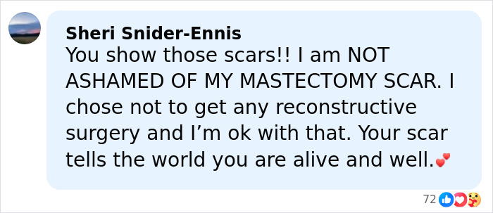 Comment praising strength in showing mastectomy scars, supporting Angelina Jolie clapping back at hateful trolls online.