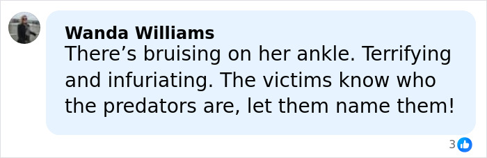 Screenshot of a social media comment highlighting bruising on a woman related to new Epstein files with disturbing messages.