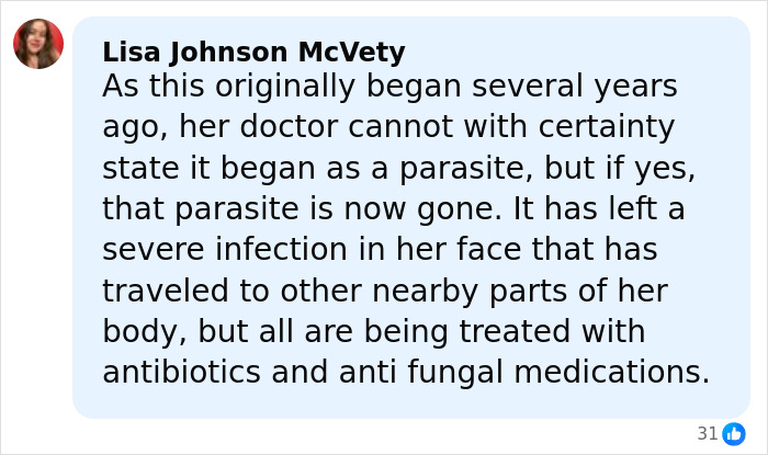 Comment from Lisa Johnson McVety explaining treatment of Brandi Glanville’s facial disfigurement caused by severe infection. Comment from Lisa Johnson McVety explaining treatment of Brandi Glanville’s facial disfigurement caused by severe infection.