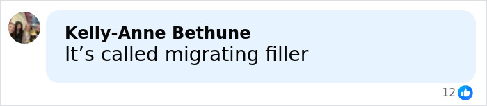 Comment by Kelly-Anne Bethune saying it’s called migrating filler on a light blue background with a small user profile image. Comment by Kelly-Anne Bethune saying it’s called migrating filler on a light blue background with a small user profile image.