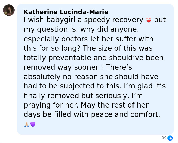 Comment expressing concern and prayers for 14YO girl with rare condition after 17-hour surgery to remove 174lb leg. Comment expressing concern and prayers for 14YO girl with rare condition after 17-hour surgery to remove 174lb leg.