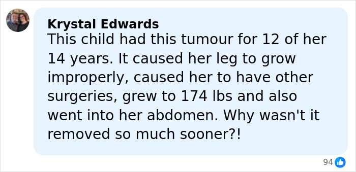 Comment from Krystal Edwards explaining 14YO girl’s rare condition causing 174lb leg growth and delayed surgery removal. Comment from Krystal Edwards explaining 14YO girl’s rare condition causing 174lb leg growth and delayed surgery removal.