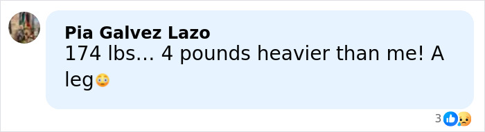 Comment from Pia Galvez Lazo reacting to a 174lb leg related to a rare condition and surgery story.