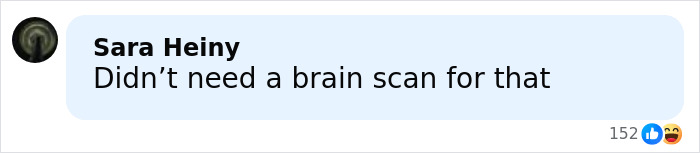 Screenshot of a social media comment humorously reacting to low brain activity after a scan discussion.