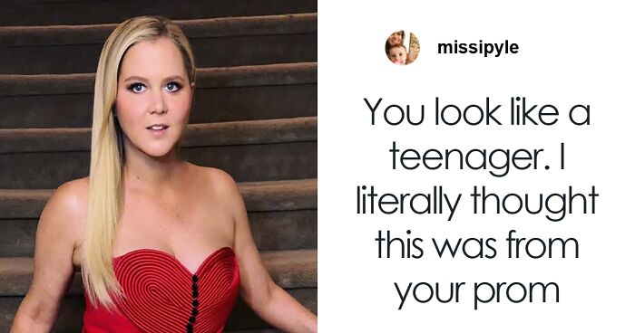 “No Mystery”: Amy Schumer Sets The Record Straight On Her Health And Cosmetic Procedures