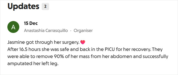 Menina de 14 anos com condição rara passa por 17 horas de cirurgia exaustiva para remover perna de 174 libras Menina de 14 anos com condição rara passa por 17 horas de cirurgia exaustiva para remover perna de 174 libras