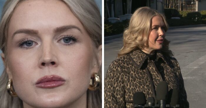 VF Photographer Defends Karoline Leavitt’s Close-Up After Mockery Over Alleged Lip Filler Marks