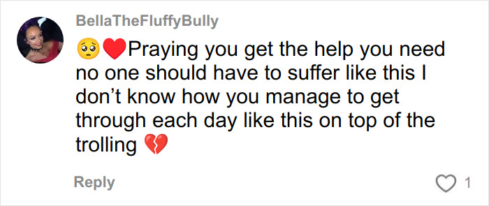 Comment expressing sympathy and support for woman who got veneers in Turkey and experienced nose collapse.