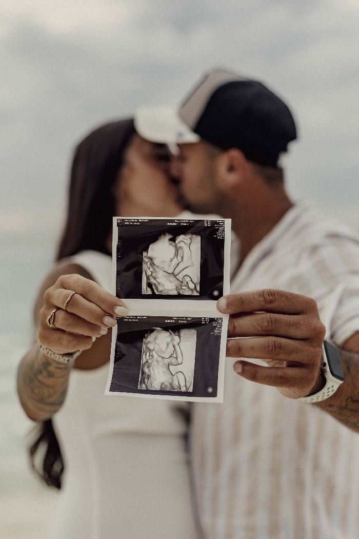 Blurred couple kissing on beach holding ultrasound photos in foreground, creative maternity photoshoot moment