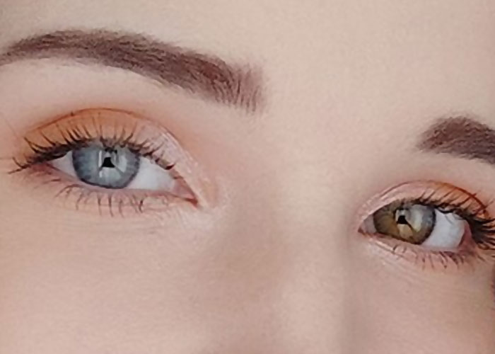 Close-up of a person with heterochromia, showcasing rare physiological traits in eye color uncommon in most people.