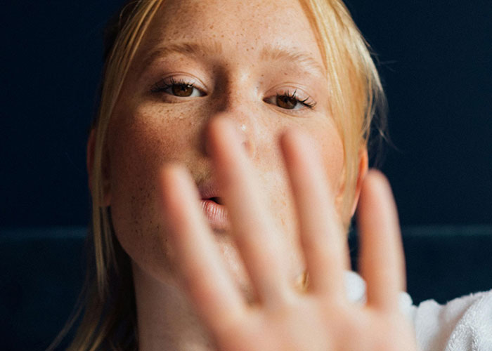 Close-up of a young person showing rare physiological traits with freckles and clear skin against a dark background.