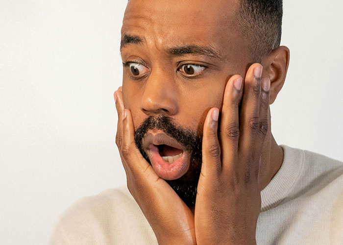 Man with rare physiological traits showing surprise, holding his face with both hands against a plain background.