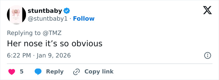 Internet Dragged Kendall Jenner After Her Claim That She’s Never Had Surgery Internet Dragged Kendall Jenner After Her Claim That She’s Never Had Surgery