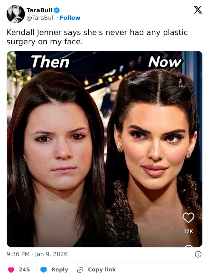 Internet Dragged Kendall Jenner After Her Claim That She’s Never Had Surgery Internet Dragged Kendall Jenner After Her Claim That She’s Never Had Surgery