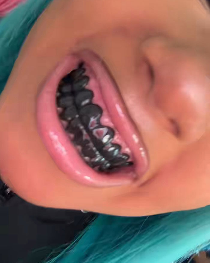 North West, 12, Shows Off New Piercings And Blackened Teeth In Video As Fans Slam Kim Kardashian North West, 12, Shows Off New Piercings And Blackened Teeth In Video As Fans Slam Kim Kardashian