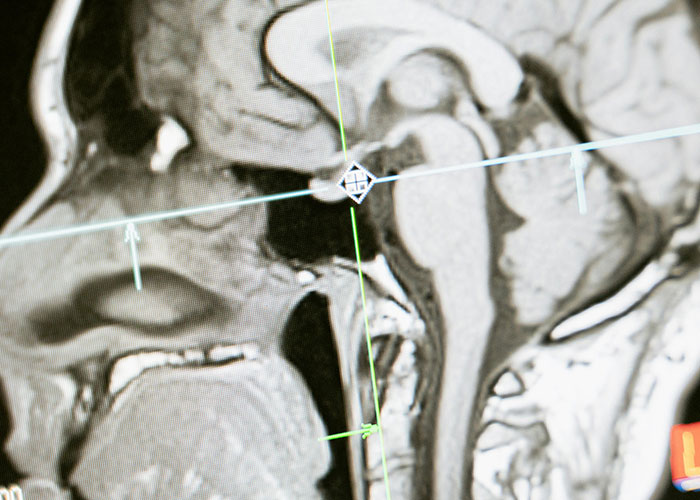 MRI scan of rare physiological traits in a human head, highlighting unique anatomy rarely seen in person.