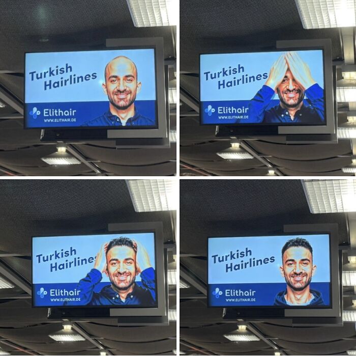 Creative print advertisement for Turkish hairlines showing a humorous transformation from bald to full hair, highlighting innovation.