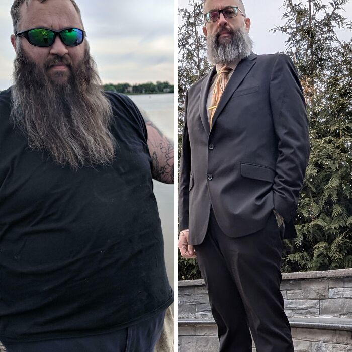 Side-by-side amazing photos of a bearded man before and after weight loss, casual sunglasses by water and dressed in a suit.