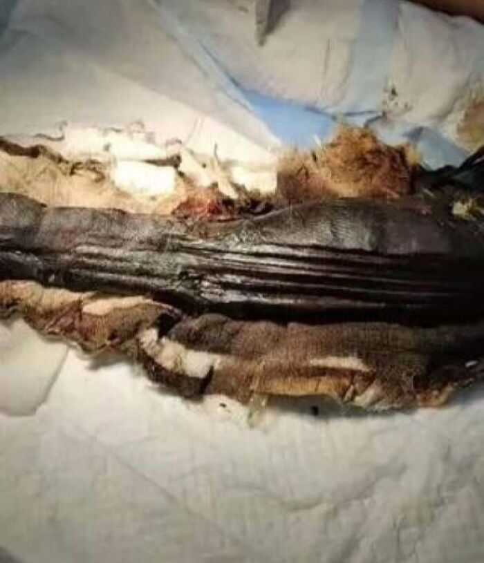 Close-up of long mummified dark tissue on surgical drape, medical pics