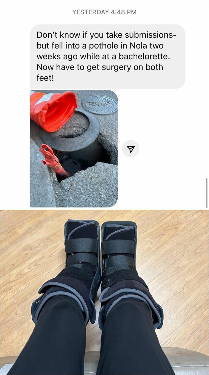 Text message about falling into a pothole in the street causing injuries, with photo of feet in medical boots after surgery.