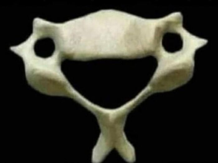 Close-up of an unnerving medical bone structure resembling a distorted pelvic or spinal anatomy on black background.