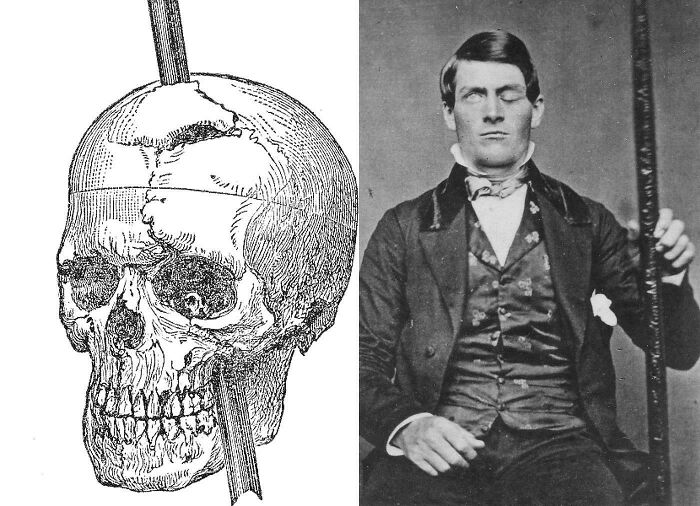 Split image showing a vintage illustration of a skull with a rod through it and an old photo of a blindfolded man, unsettling crime.