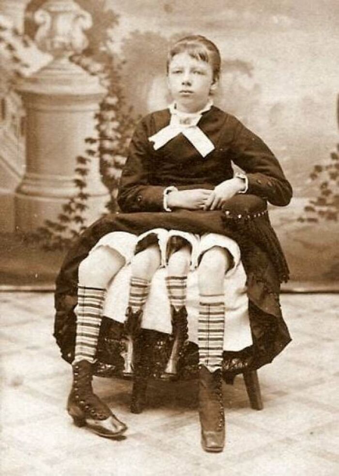 Victorian era photo of a seated girl with a unique striped stocking illusion, showcasing the different time period style.