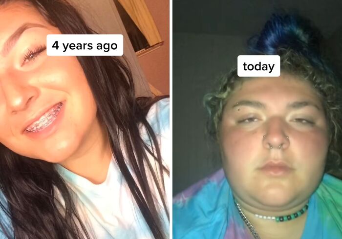 Side-by-side photos showing personal glow down transformation over 4 years shared by people being vulnerable online.