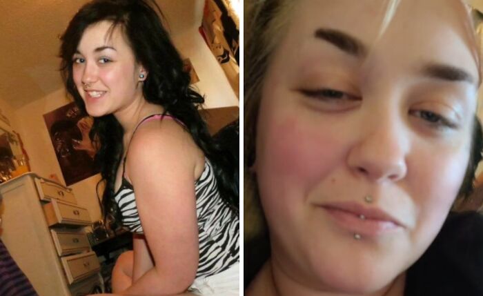 Before and after photos showing a woman’s glow down transformation as part of people sharing their glow down stories.