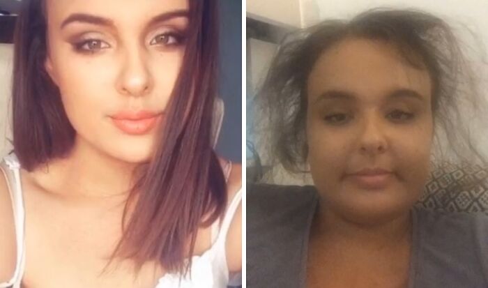 Side-by-side photos showing a woman’s glow down transformation highlighting people who have glowed down since their peak.