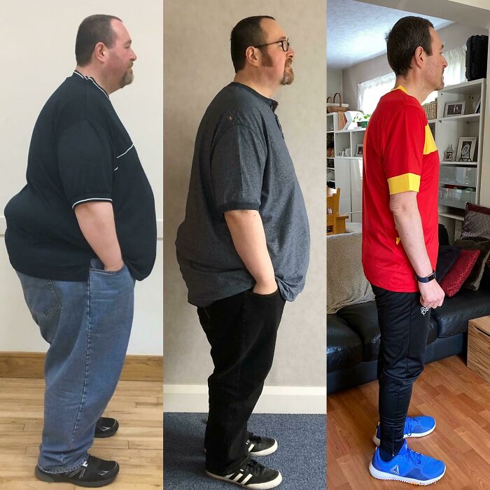 Three-panel side view of a man showing dramatic before and after weight loss transformation over time.