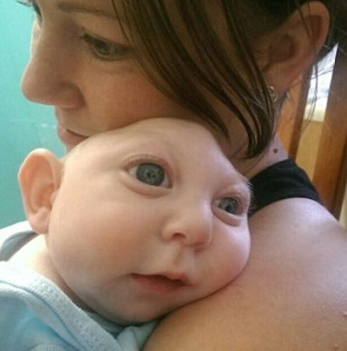 Infants with unusual facial features captured in fascinating and unnerving medical pics showing rare conditions and expressions.