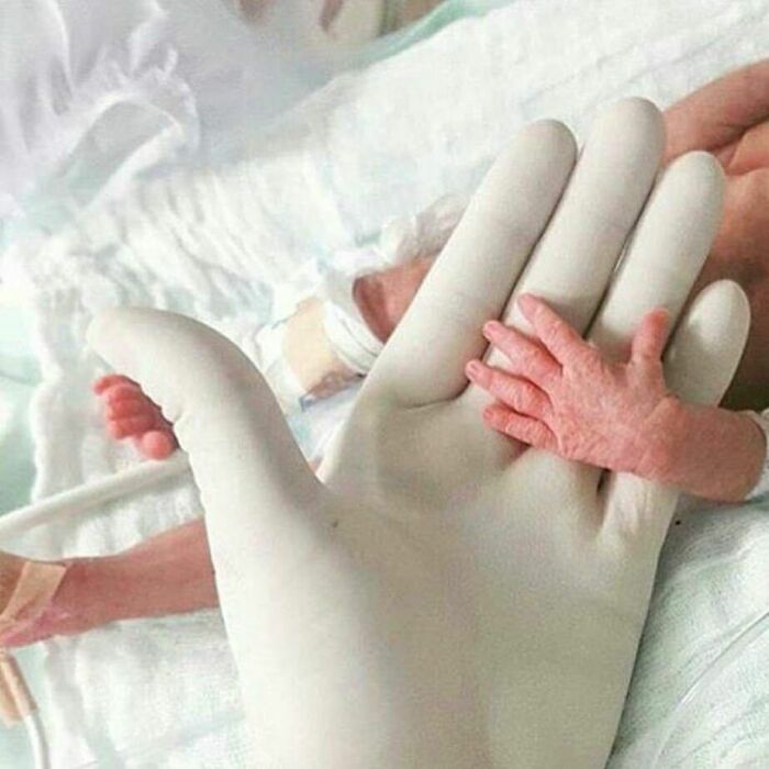 Premature baby's tiny hand resting on a gloved medical hand, illustrating scale in fascinating and unnerving medical pics.