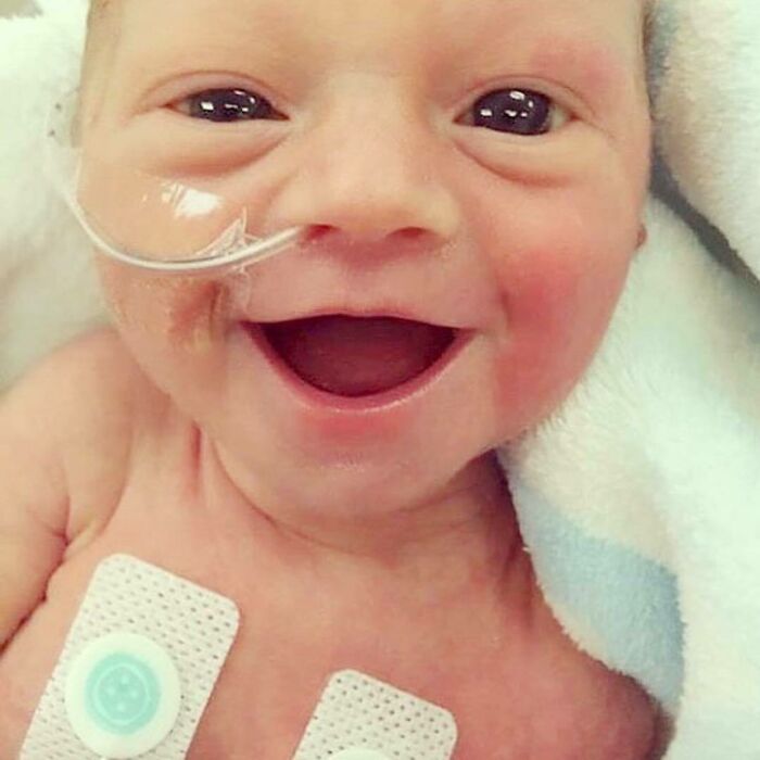 Smiling baby with medical monitoring patches and nasal tube, illustrating fascinating and unnerving medical pics.