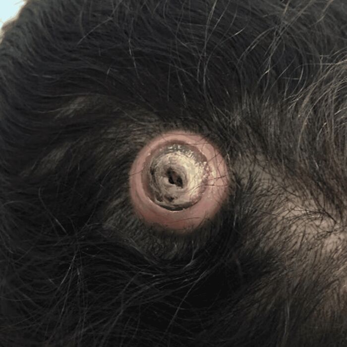 Close-up of a scalp wound with an unusual circular lesion, a fascinating and unnerving medical pic to process.