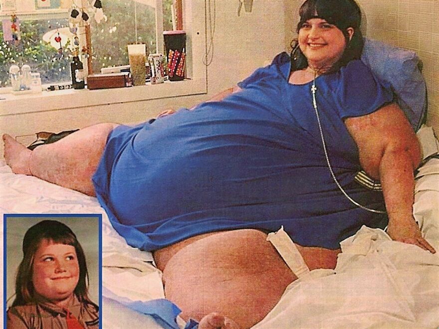 A Carol Yager in a blue dress lying on a bed, exemplifying some of the heaviest recorded people in history.