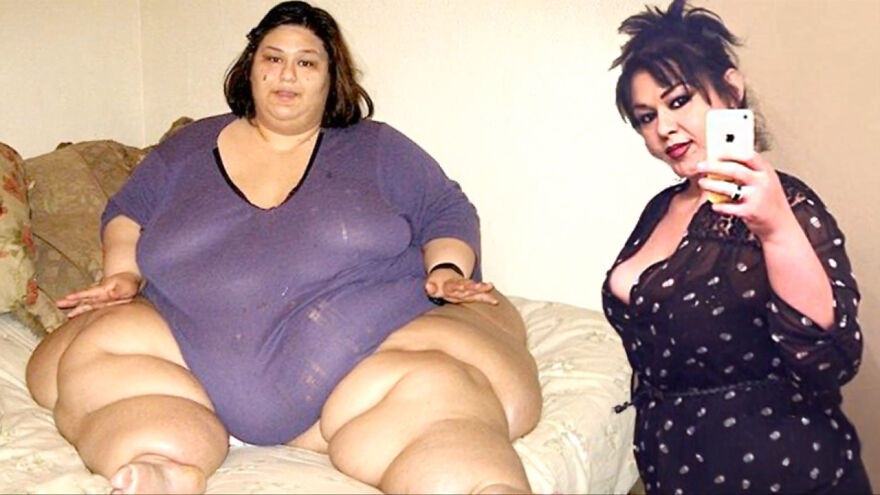 Before and after photo showing remarkable stories of the Mayra Rosales