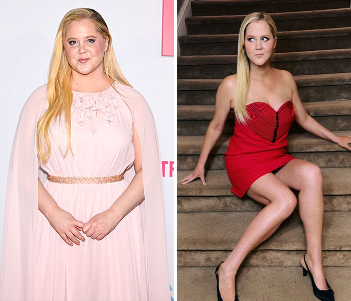 Amy Schumer