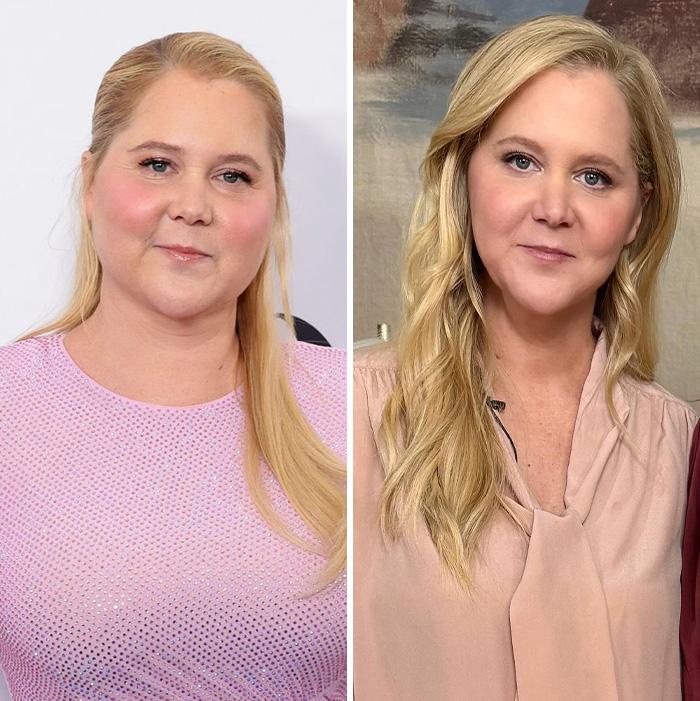 Amy Schumer posing in two side-by-side portraits, showcasing her expressions amid divorce and bikini photo backlash. Amy Schumer posing in two side-by-side portraits, showcasing her expressions amid divorce and bikini photo backlash.
