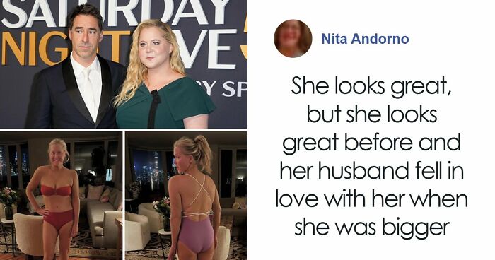 57 Fascinating And Unnerving Medical Photos Not Everyone Can Handle (New Pics)