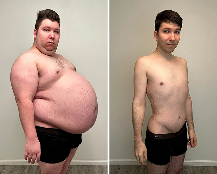 Plastic Surgeon Goes Viral After Dry Response To Facelift Critic Leaves Internet Laughing Hard Plastic Surgeon Goes Viral After Dry Response To Facelift Critic Leaves Internet Laughing Hard