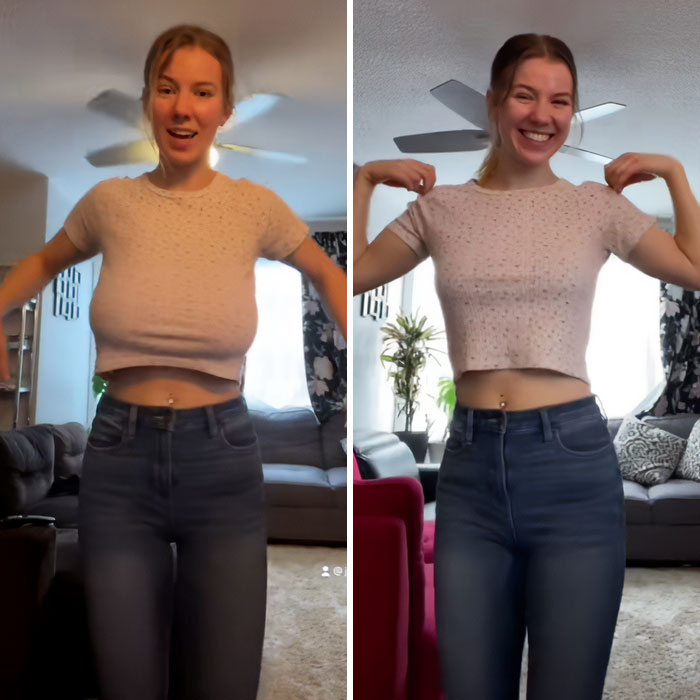 Woman wearing pink shirt and jeans before and after breast reduction, smiling in a home living room setting. Woman wearing pink shirt and jeans before and after breast reduction, smiling in a home living room setting.