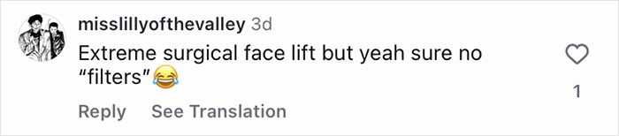Screenshot of an Instagram comment discussing extreme surgical face lift and mentioning no filters with a laughing emoji.
